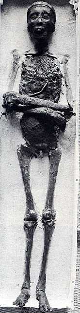 De mummie van Toetanchamon