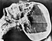 Röntgenfoto van het hoofd van de mummie van Toetanchamon